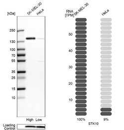 LOK Antibody, Novus Biologicals 0.1mL; Unlabeled:Antibodies, Polyclonal